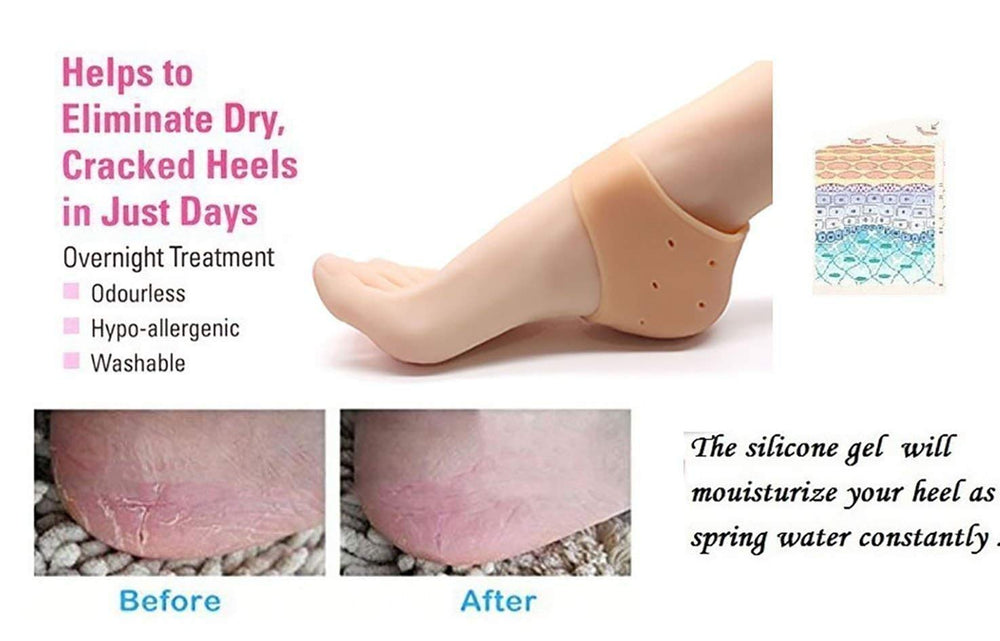Silicone Anti-Crack Half Heel Socks